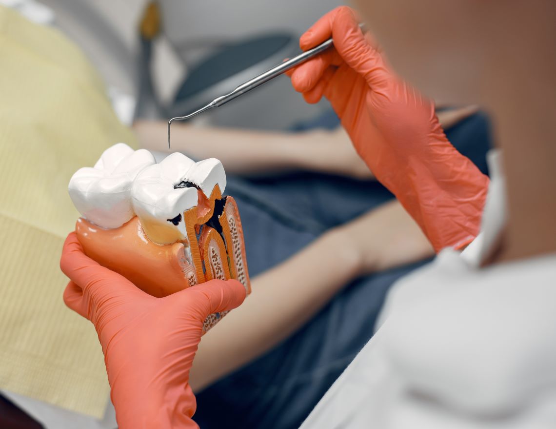 Benefits of Root Canal Treatment