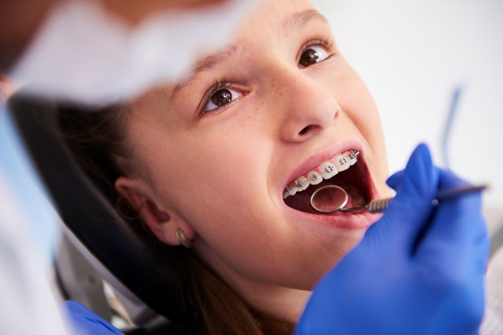 Dental Implant Cost